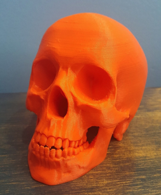 3d printed skull
