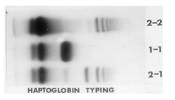 Image of haptoglobin typing