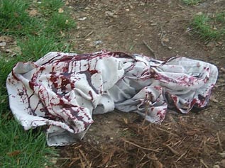 Image of evidence (cloth with blood)