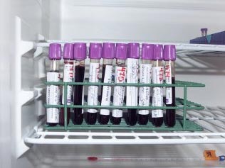 Image of samples in refrigerator
