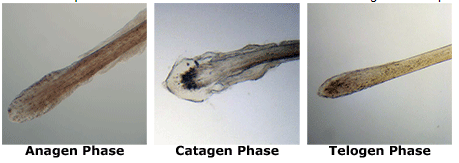 Images of hair follicles in Anagen phase, Catagen phase, and Telogen phase