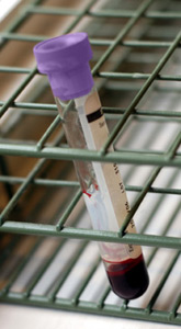 photo of a test tube filled with blood