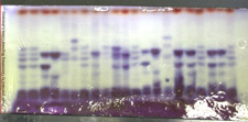 photo of iso enzyme and protein typing