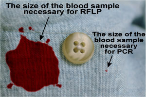 Zoomed in photo of a shirt button with a large blood splatter on the left hand side, and a small dot of blood on the right side. 