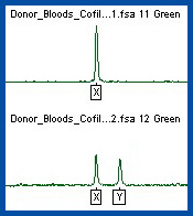 Image of two graphs. One shows a line graph with an X chromosome, the second shows a line graph with both an X and a Y chromosome