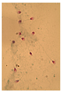 Image of microscopy screening