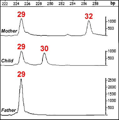 An example of a mutation in the STR locus D21S11 of the father causing allele mismatch in the child. 
