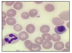Image of red and white blood cells