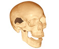 Image of a human skull with a bullet wound