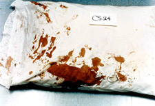 Photo of a bloody pillowcase