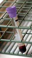 Photo of a blood sample vial in a lab
