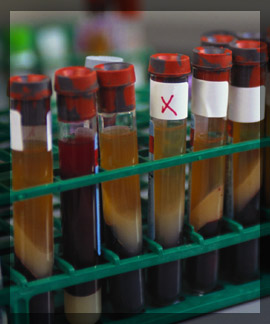 Photo of dna evidence vial samples in a lab