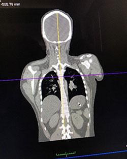 Three-Dimensional Scan and CT Scan