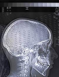 xray of human skull