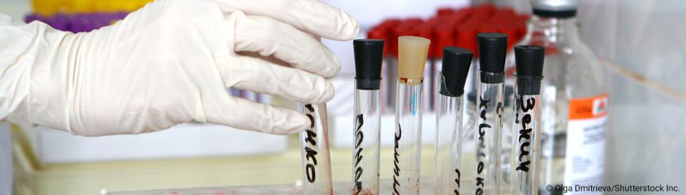 test tubes in a rack