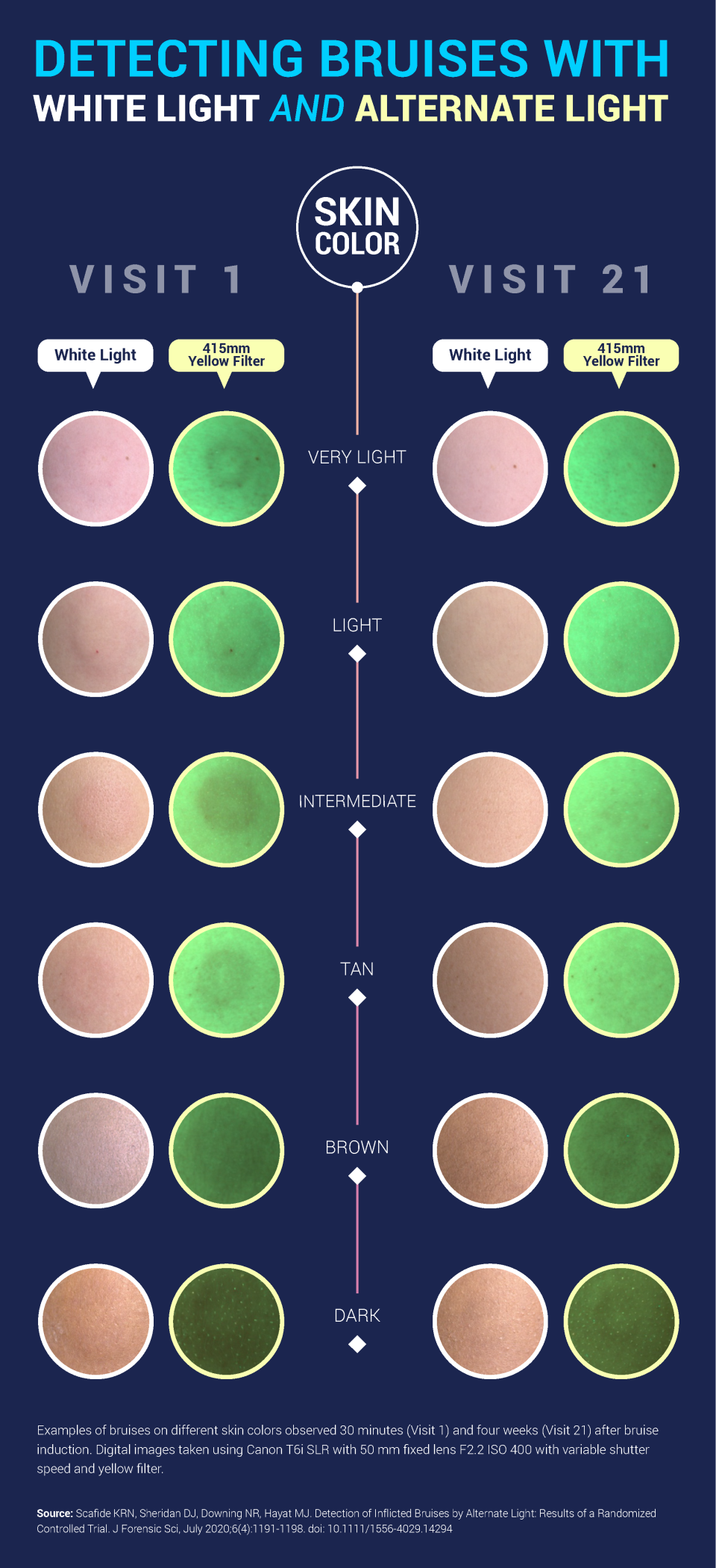 Detecting Bruises With Alternate White Light and Alternate Light