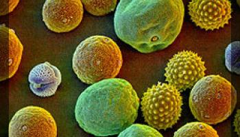 Photo of pollen and spores commonly shown in forensic palynology